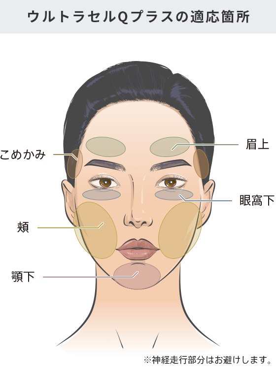 ウルトラセルQプラス（HIFU） | 美容整形は東京美容外科