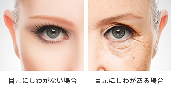 目元のしわ たるみを改善する高周波治療 エイジレスrf 美容整形は東京美容外科