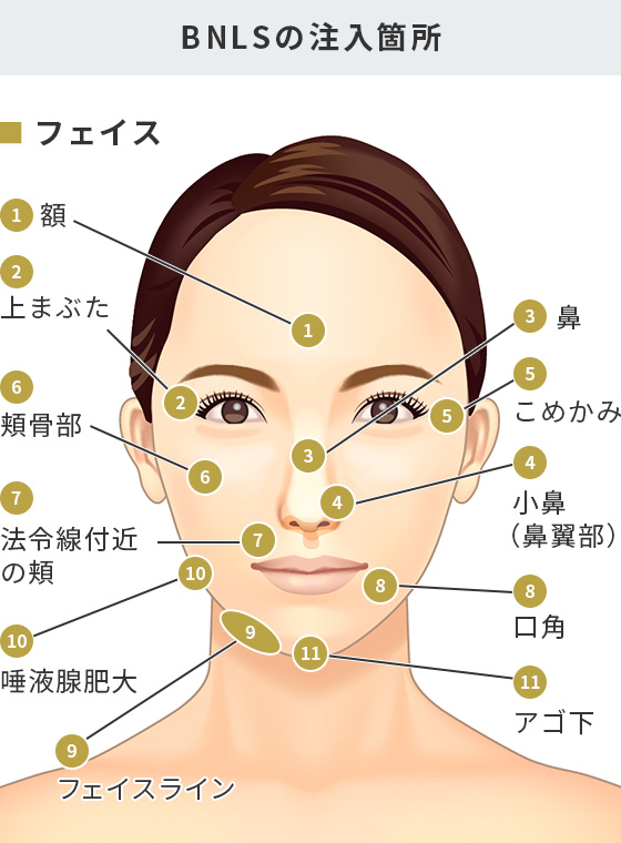 Bnls注射 腫れにくい脂肪溶解注射 美容整形は東京美容外科